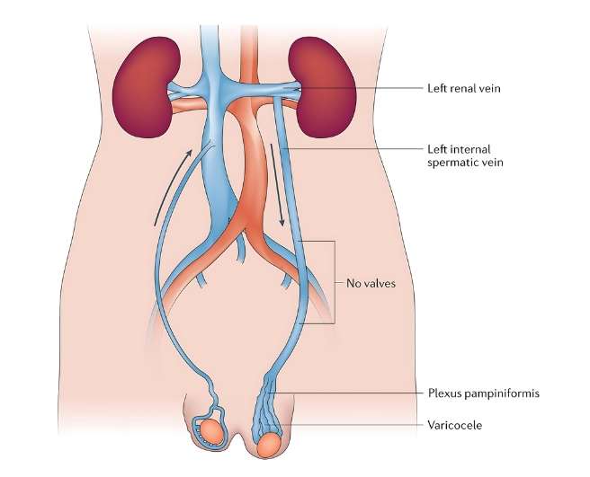 Respiratory ailments