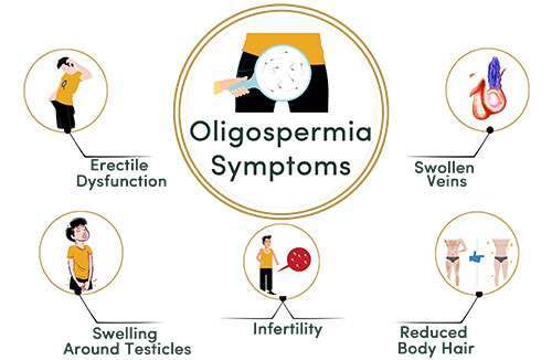 Oligospermia 3 1